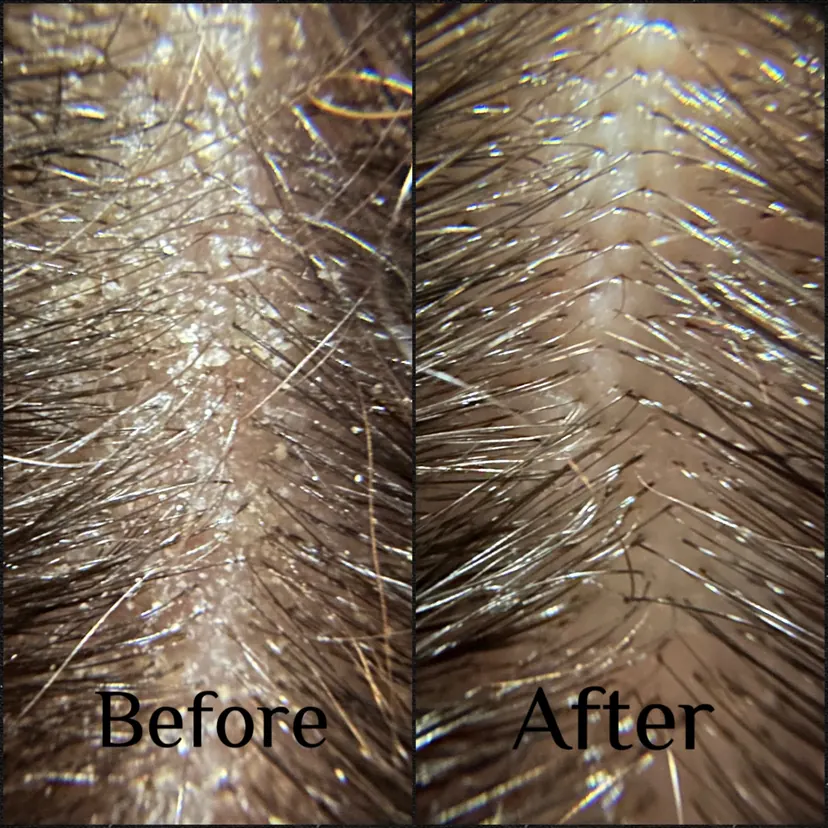 Scalp buildup before and after a single Hair Play Method service on light brown hair