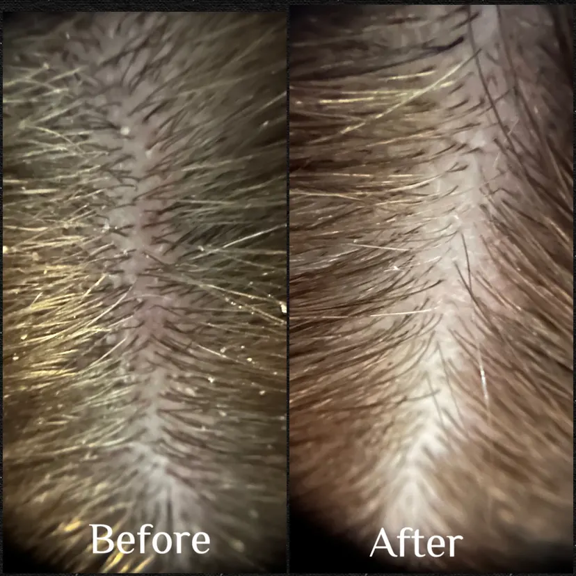 Moderate scalp buildup before and after one Hair Play Method service