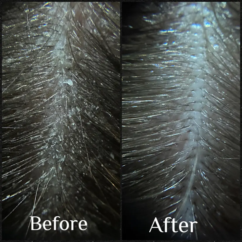 Dark hair on a pale scalp before and after a single Hair Play Method service